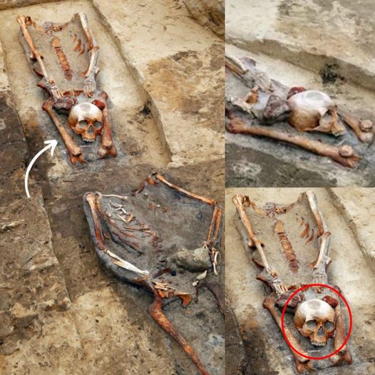 The Mysterious "Vampire"Graves: Skeletons Interred with Skulls Positioned Between Their Legs 