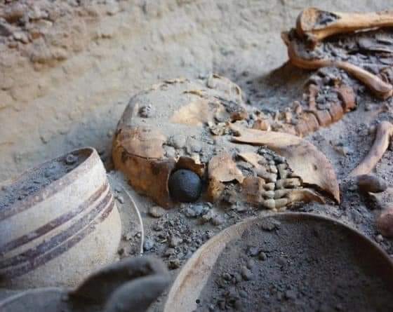 Exploring the Marvels of Ancient Innovation: The World's Earliest Ocular Prosthesis