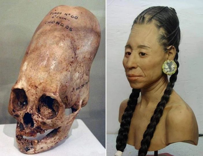 Unveiling the Enigma of Paracas: The Mystery of Elongated Skulls