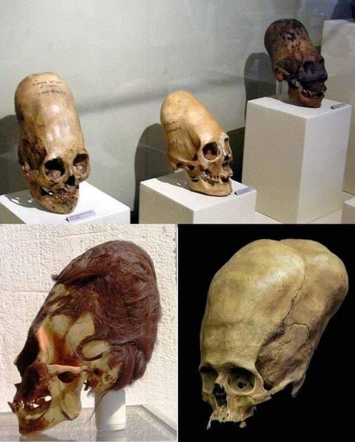 Exploring the Enigmatic Paracas Skulls: Unraveling Ancient Mysteries