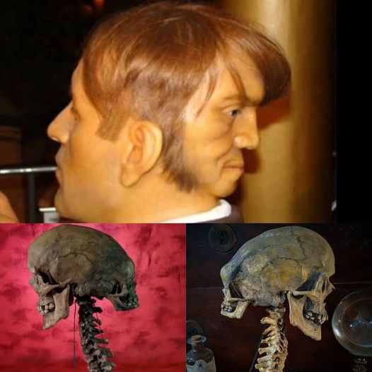 Deciphering the Enigma of the Two-Headed Skull: Investigating Archaeological Autopsy Findings for Answers.