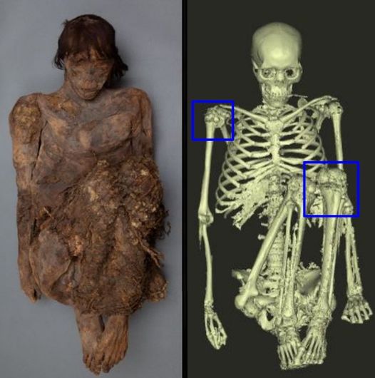 Archival records state that this individual is a possible female Basketmaker mummy found in a cave in Colorado River Canyon.