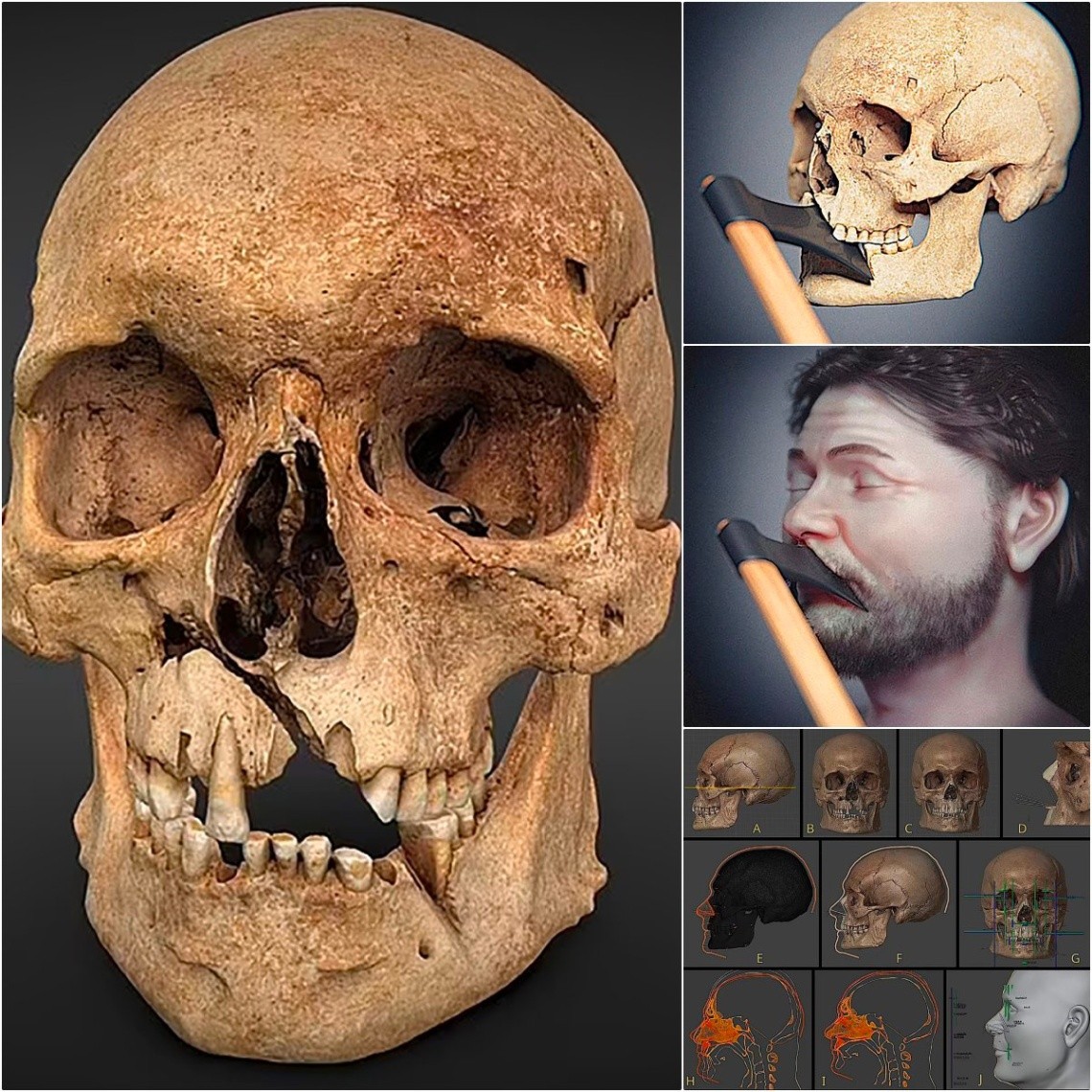 Unveiling the Visage of History: Reconstructing the Face of a Medieval Warrior Who Died in 1361